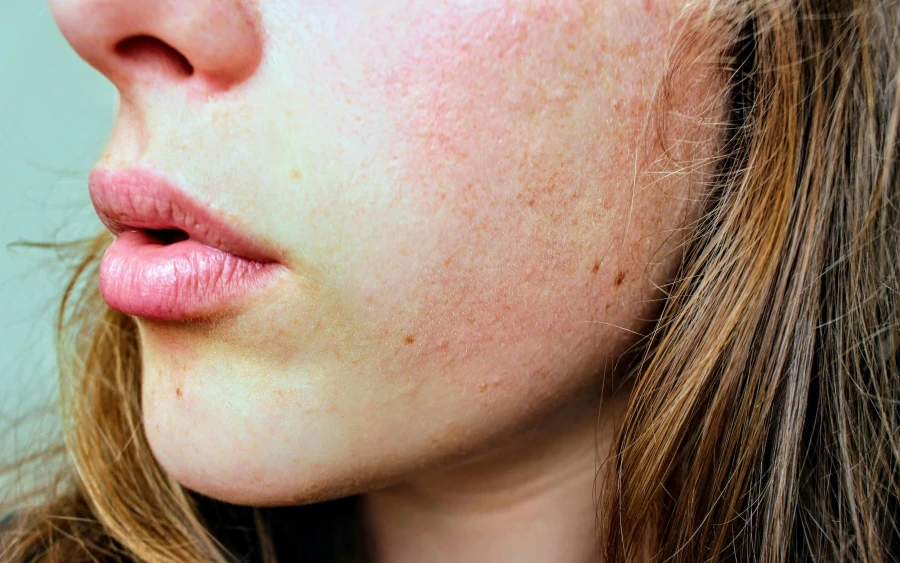 Herfst skincare -tips zo verzorg je je huid - My Daily Favorite